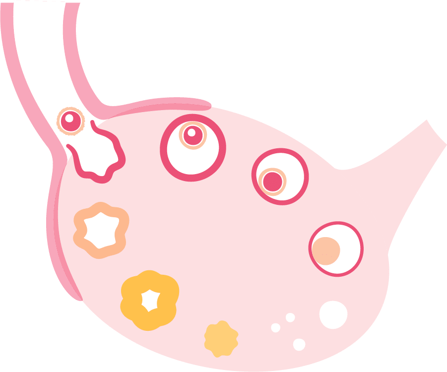 An illustration of a stomach showcasing fertility treatment.